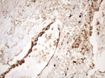 KRT16 Antibody in Immunohistochemistry (Paraffin) (IHC (P))