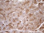 KRT16 Antibody in Immunohistochemistry (Paraffin) (IHC (P))