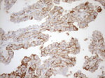 KRT16 Antibody in Immunohistochemistry (Paraffin) (IHC (P))