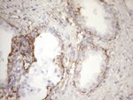KRT16 Antibody in Immunohistochemistry (Paraffin) (IHC (P))