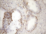 KRT16 Antibody in Immunohistochemistry (Paraffin) (IHC (P))
