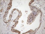 KRT16 Antibody in Immunohistochemistry (Paraffin) (IHC (P))