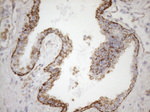 KRT16 Antibody in Immunohistochemistry (Paraffin) (IHC (P))