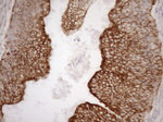 KRT16 Antibody in Immunohistochemistry (Paraffin) (IHC (P))