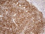 KRT16 Antibody in Immunohistochemistry (Paraffin) (IHC (P))