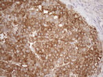 KRT16 Antibody in Immunohistochemistry (Paraffin) (IHC (P))
