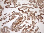 KRT16 Antibody in Immunohistochemistry (Paraffin) (IHC (P))