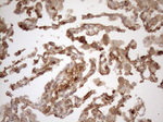 KRT16 Antibody in Immunohistochemistry (Paraffin) (IHC (P))
