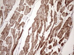 KRT16 Antibody in Immunohistochemistry (Paraffin) (IHC (P))