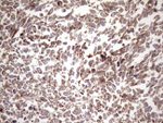 KRT16 Antibody in Immunohistochemistry (Paraffin) (IHC (P))