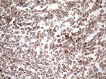 KRT16 Antibody in Immunohistochemistry (Paraffin) (IHC (P))
