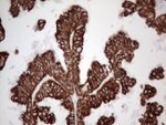KRT16 Antibody in Immunohistochemistry (Paraffin) (IHC (P))