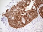 KRT16 Antibody in Immunohistochemistry (Paraffin) (IHC (P))