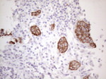 KRT16 Antibody in Immunohistochemistry (Paraffin) (IHC (P))