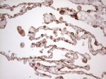 KRT16 Antibody in Immunohistochemistry (Paraffin) (IHC (P))