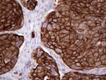 KRT16 Antibody in Immunohistochemistry (Paraffin) (IHC (P))
