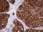 KRT16 Antibody in Immunohistochemistry (Paraffin) (IHC (P))