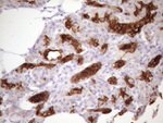 KRT16 Antibody in Immunohistochemistry (Paraffin) (IHC (P))