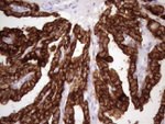 KRT16 Antibody in Immunohistochemistry (Paraffin) (IHC (P))