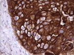 KRT16 Antibody in Immunohistochemistry (Paraffin) (IHC (P))