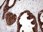 KRT16 Antibody in Immunohistochemistry (Paraffin) (IHC (P))