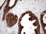 KRT16 Antibody in Immunohistochemistry (Paraffin) (IHC (P))