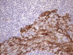 KRT16 Antibody in Immunohistochemistry (Paraffin) (IHC (P))