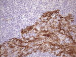 KRT16 Antibody in Immunohistochemistry (Paraffin) (IHC (P))