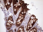 KRT16 Antibody in Immunohistochemistry (Paraffin) (IHC (P))