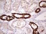 KRT16 Antibody in Immunohistochemistry (Paraffin) (IHC (P))