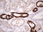 KRT16 Antibody in Immunohistochemistry (Paraffin) (IHC (P))