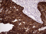 KRT16 Antibody in Immunohistochemistry (Paraffin) (IHC (P))