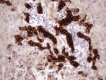 KRT16 Antibody in Immunohistochemistry (Paraffin) (IHC (P))