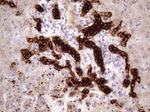 KRT16 Antibody in Immunohistochemistry (Paraffin) (IHC (P))