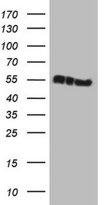 KRT16 Antibody in Western Blot (WB)