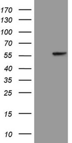 KRT16 Antibody in Western Blot (WB)