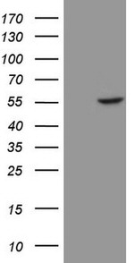 KRT16 Antibody in Western Blot (WB)