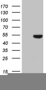 KRT16 Antibody in Western Blot (WB)