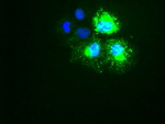 KRT18 Antibody in Immunocytochemistry (ICC/IF)