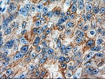 KRT18 Antibody in Immunohistochemistry (Paraffin) (IHC (P))