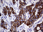 KRT18 Antibody in Immunohistochemistry (Paraffin) (IHC (P))