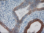 KRT18 Antibody in Immunohistochemistry (Paraffin) (IHC (P))