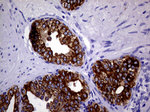KRT18 Antibody in Immunohistochemistry (Paraffin) (IHC (P))