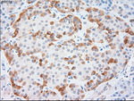 KRT18 Antibody in Immunohistochemistry (Paraffin) (IHC (P))