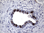 KRT18 Antibody in Immunohistochemistry (Paraffin) (IHC (P))