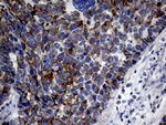 KRT18 Antibody in Immunohistochemistry (Paraffin) (IHC (P))