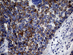 KRT18 Antibody in Immunohistochemistry (Paraffin) (IHC (P))