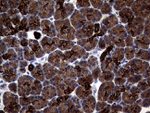 KRT18 Antibody in Immunohistochemistry (Paraffin) (IHC (P))