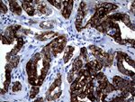 KRT18 Antibody in Immunohistochemistry (Paraffin) (IHC (P))