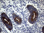 KRT18 Antibody in Immunohistochemistry (Paraffin) (IHC (P))